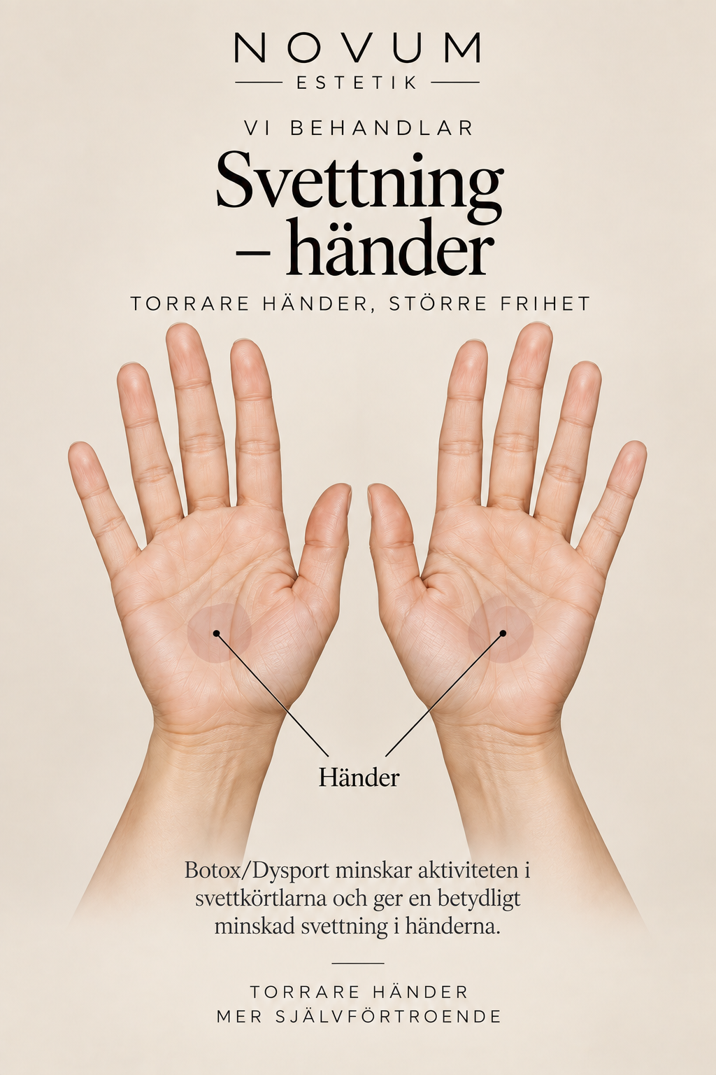 Vi behandlar svettning i händer – Torrare händer, större frihet